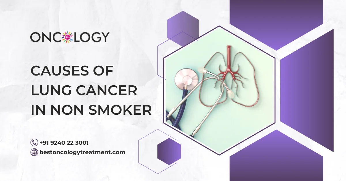Causes Of Lung Cancer In Non Smoker